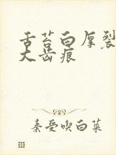 舌苔白厚裂纹肥大齿痕