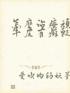 怎么治疗顽固性牛皮有癣较好