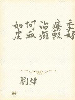 如何治疗季节牛皮血癣较好