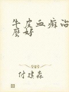 牛皮血癣治疗什么好