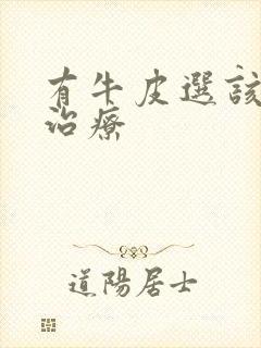 有牛皮选该怎么治疗