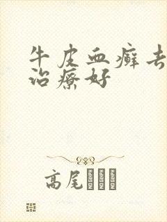 牛皮血癣去哪里治疗好