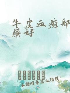 牛皮血癣哪里治疗好