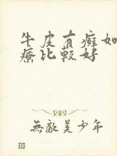 牛皮有癣如何治疗比较好