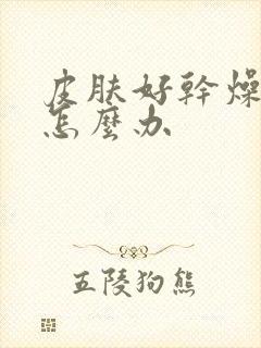 皮肤好干燥粗糙怎么办