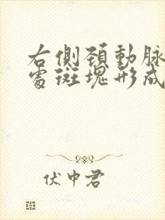 右侧颈动脉分叉处斑块形成是什么意思