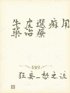 牛皮选癣用什么药治疗