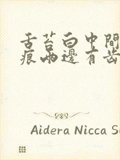 舌苔白中间有裂痕两边有齿痕