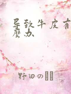 导致牛皮有癣怎么办