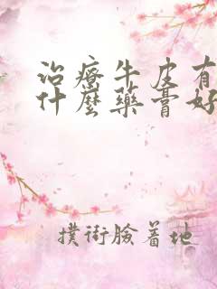 治疗牛皮有癣用什么药膏好