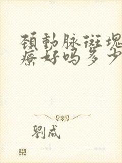 颈动脉斑块能治疗好吗多少钱