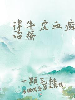 得牛皮血癣怎么治疗