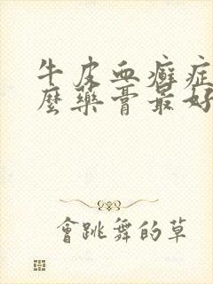 牛皮血癣症用什么药膏最好