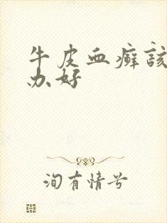 牛皮血癣该怎么办好