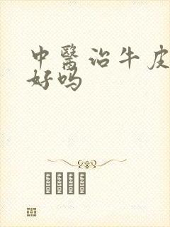 中医治牛皮血癣好吗