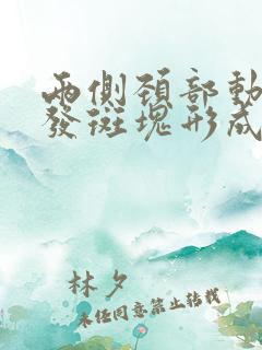 两侧颈部动脉多发斑块形成