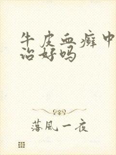 牛皮血癣中医能治好吗