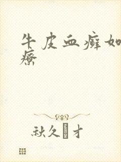 牛皮血癣如何治疗