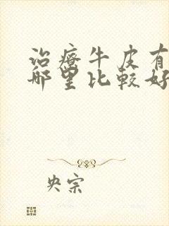 治疗牛皮有癣去哪里比较好