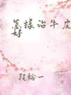 怎样治牛皮比较好