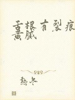 舌根有裂痕舌苔黄腻