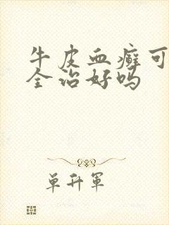 牛皮血癣可以完全治好吗