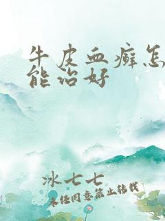 牛皮血癣怎么才能治好