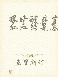 眼睛酸疼有大量红血丝是怎么回事