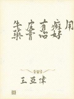 牛皮有癣用什么药膏治好