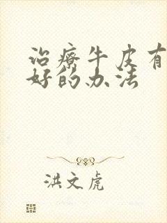 治疗牛皮有癣最好的办法