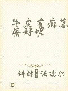 牛皮有癣怎么治疗好呢