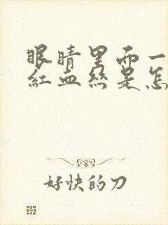 眼睛里面一直有红血丝是怎么回事