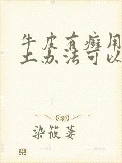 牛皮有癣用什么土办法可以治好