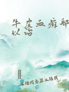 牛皮血癣哪里可以治