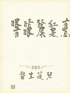 眼睛发红有血丝有眼屎是怎么回事