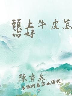 头上牛皮怎样能治好