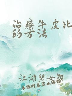 治疗牛皮比较好的方法