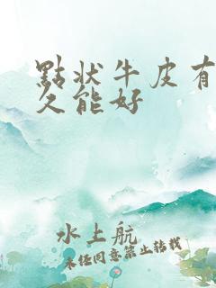 点状牛皮有癣多久能好