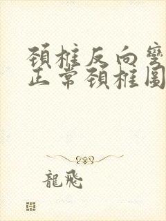 颈椎反向弯曲和正常颈椎图片