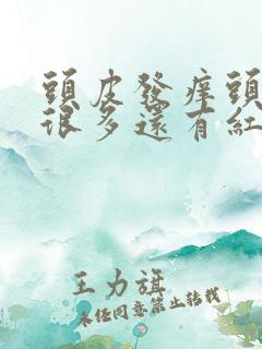 头皮发痒头皮屑很多还有红疙瘩