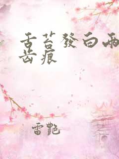 舌苔发白两侧有齿痕