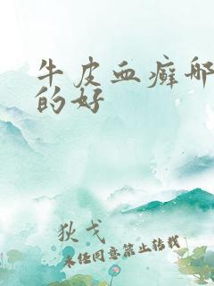 牛皮血癣哪里治的好