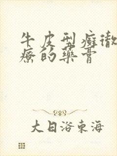 牛皮型癣彻底治疗的药膏