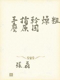 手指干燥粗糙什么原因