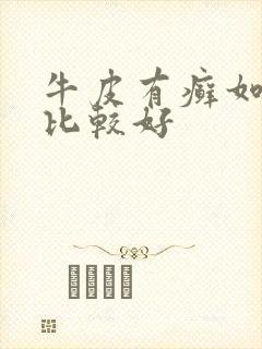 牛皮有癣如何治比较好