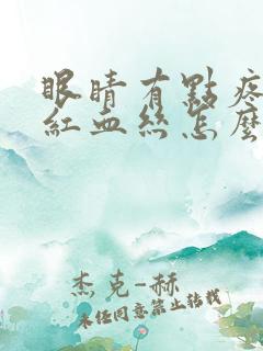 眼睛有点疼还有红血丝怎么回事