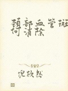 颈部血管斑块如何消除