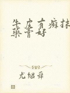 牛皮有癣抹什么药膏好