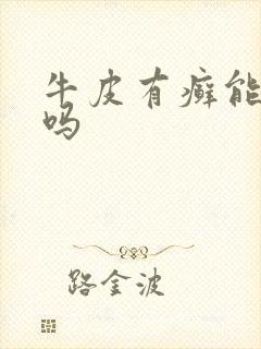 牛皮有癣能祛除吗