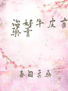 治好牛皮有癣的药膏